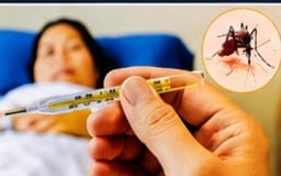 Dengue