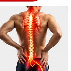 Sciatica