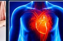 Cardiac Issues