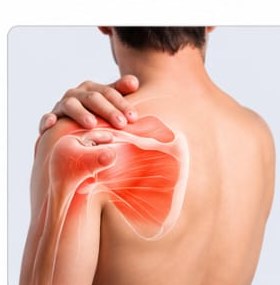 Shoulder Pain