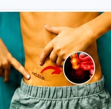 Appendix